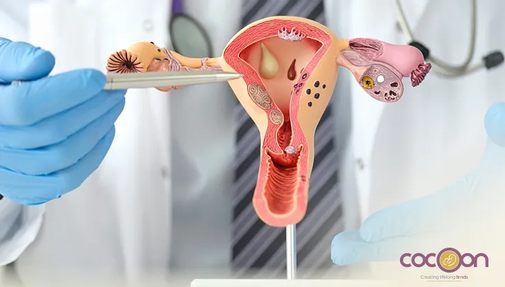 Ovarian Cyst, Adnexal Mass & Tubal Blocks: Understanding Fertility Barriers