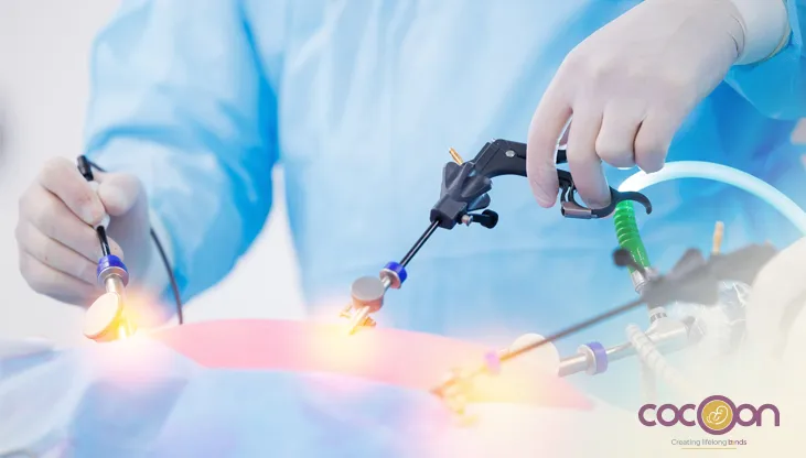 Laparoscopic Surgery for Ovarian Cysts & Endometriosis