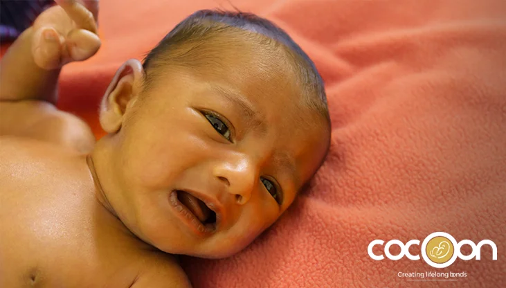 Neonatal Jaundice: Causes, Symptoms & Best Treatment Options