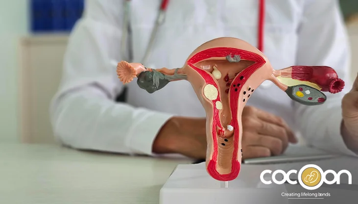 Endometriosis Symptoms: How to Identify and Treat Them Early